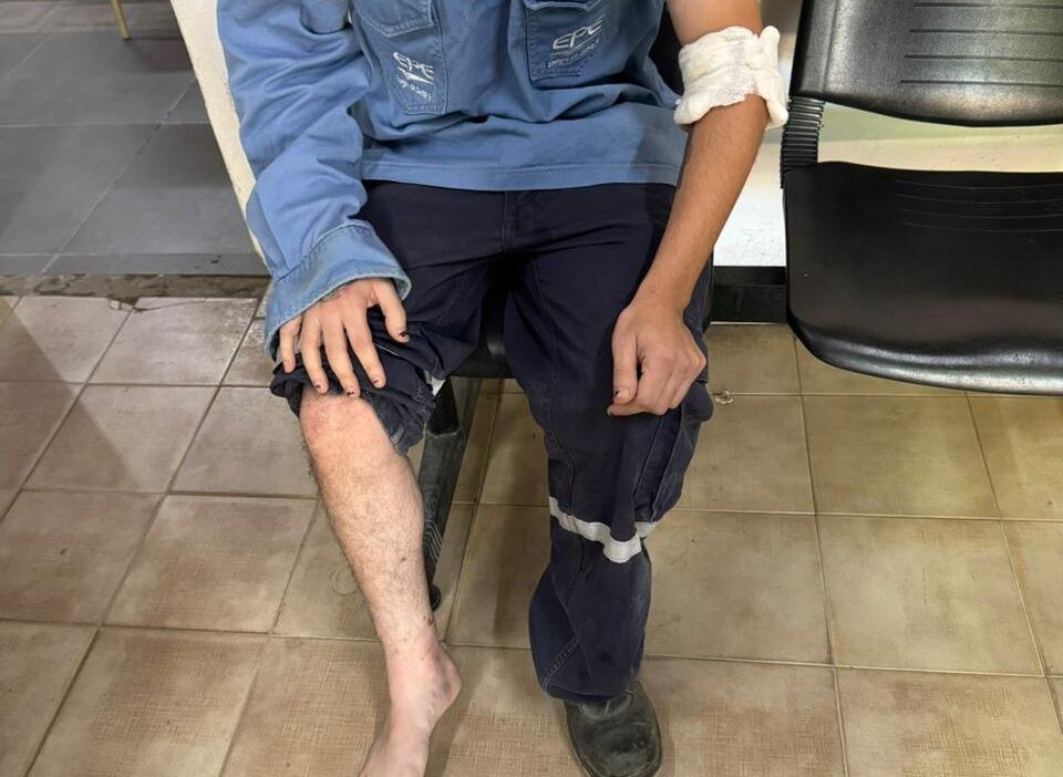 Un empleado de la EPE fue atacado por un grupo de perros | Noticias