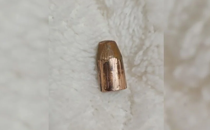 San José del Rincón: un adolescente de 13 años resultó herido al hacer explotar una bala de 9 mm con una pinza | Policiales