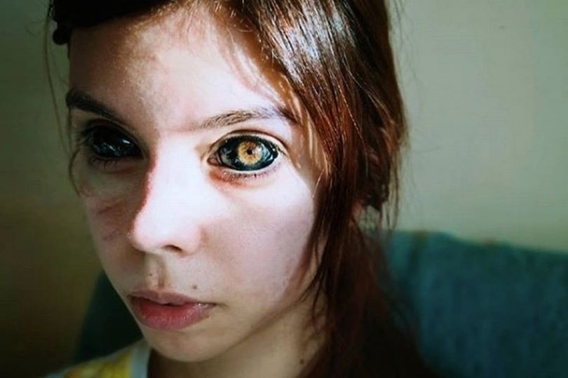 Una chica quiso imitar a un rapero, se tatuó los ojos de negro y quedó ciega | Redes