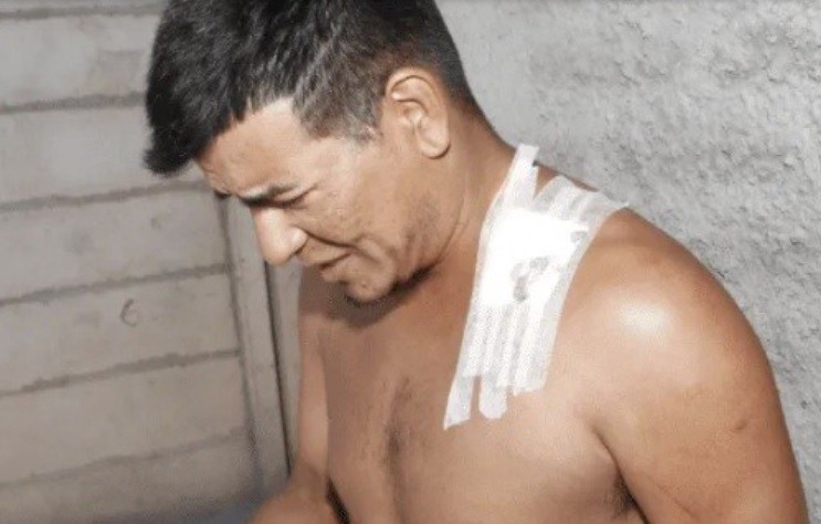 Lo apuñaló su novia y a las pocas horas la perdonó: "acá, con mi tóxica..." | Nacionales