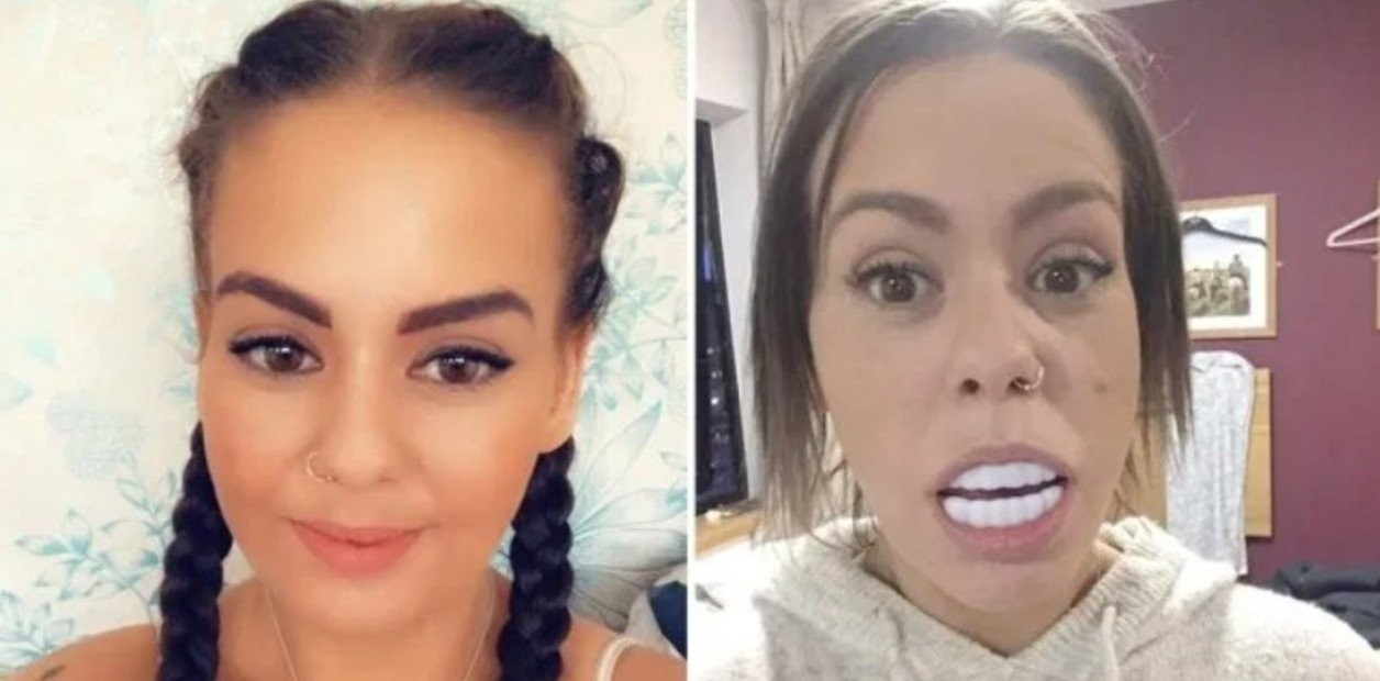 Quería tener una sonrisa perfecta, compró una dentadura por Internet y ahora no puede cerrar la boca | Redes