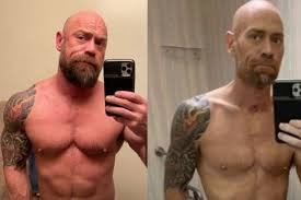 Las huellas del coronavirus: el terrible cambio físico de un hombre que tuvo covid-19 | Información General