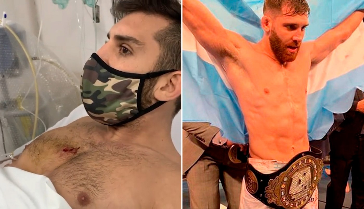 Buscan a los ladrones que balearon en el pecho a un peleador de MMA en Lanús | Deportes