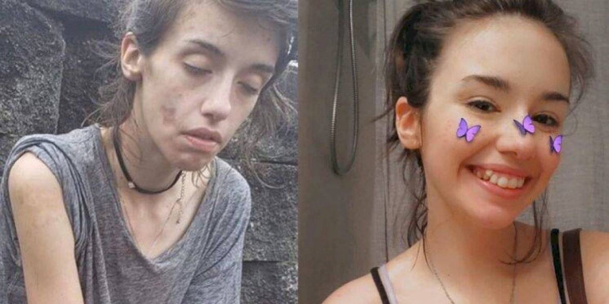 Una chica subió su foto "antes y después" para mostrar cómo se recuperó de su adicción a las drogas | Redes