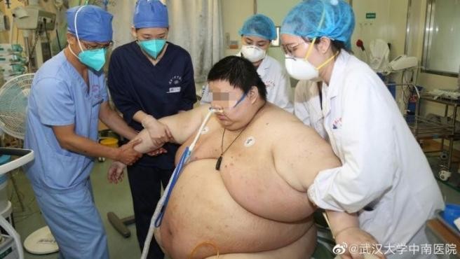 El joven que aumentó 100 kilos durante la cuarentena en Wuhan | Información General
