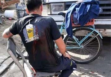 El primo del rugbier Máximo Thomsen apuñaló a un cartero | Información General