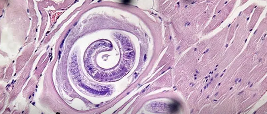 Triquinosis: más de 50 casos en Nelson y se analizan una decena en Paiva | Noticias