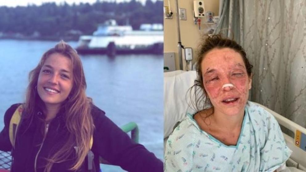 Intentó hacer jabón con un tutorial de Internet y se quemó los ojos | Redes