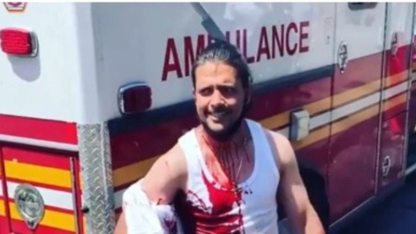 Video impactante: un hombre camina con un cuchillo clavado en la cabeza luego de ser atacado | Redes