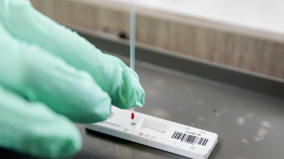 El test serológico argentino para COVID-19 llegó a los 100.000 ensayos | Información General