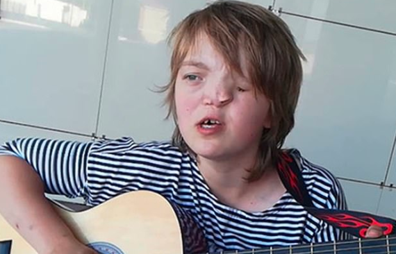 Su padre la abandonó porque nació con media cara: ahora lo busca en las redes para reencontrarse | Redes