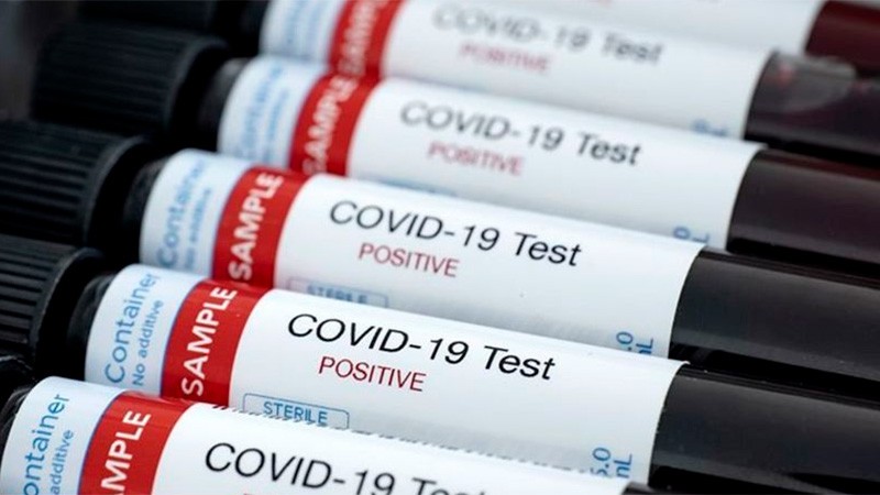 Se registraron 10 nuevos casos de coronavirus: 9 se sumaron en Paraná | Noticias