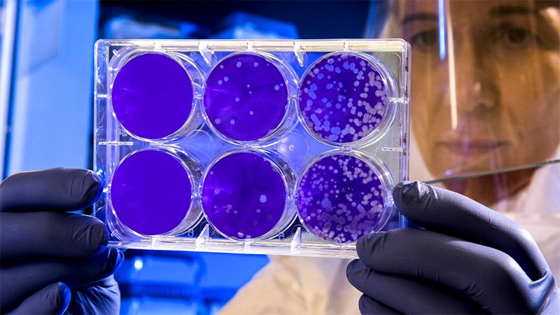 Entre Ríos: 6 nuevos casos de coronavirus este domingo y 4 son de Paraná | Noticias