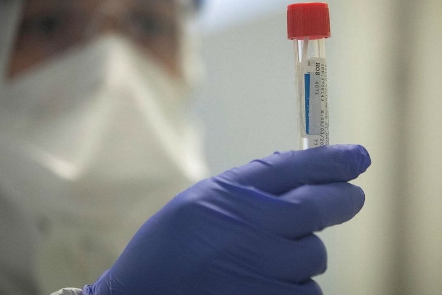 Nueve casos de Covid-19 en tres departamentos de Entre Ríos: Siete son de Paraná | Información General