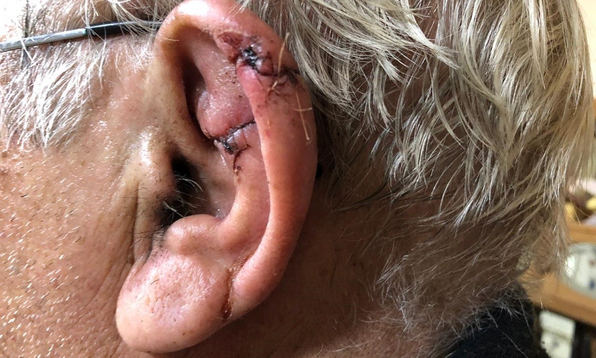 Por miedo al coronavirus y para no ir al hospital, se hizo coser la oreja por un veterinario | Información General
