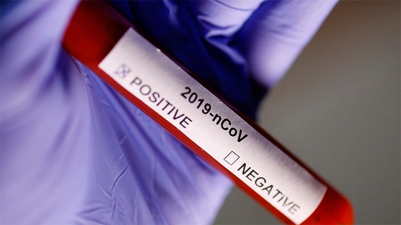 Se registraron 20 casos de coronavirus en seis departamentos: seis son de Paraná | Información General