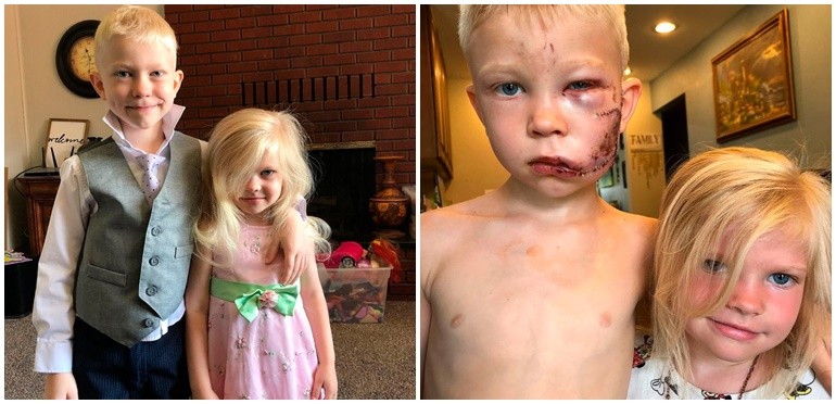 Pequeño gran héroe: un chico de 6 años salvó a su hermana del ataque de un perro | Redes