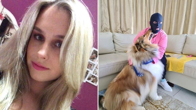 Muestra en Instagram la dolorosa recuperación tras sobrevivir a la erupción de un volcán | Redes