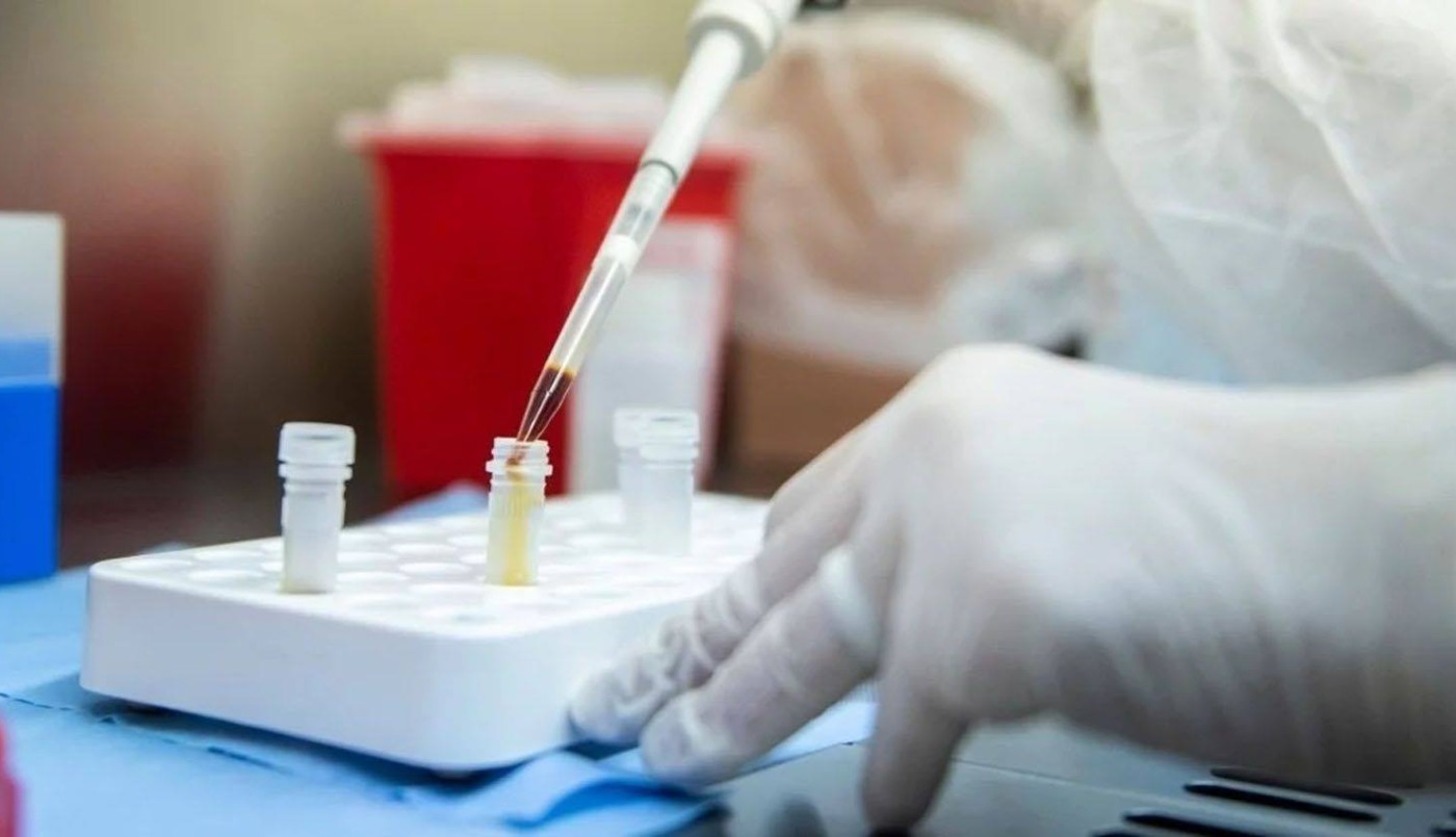 Coronavirus: dio negativo el hisopado a una empleada del Ministerio de la Producción | Noticias