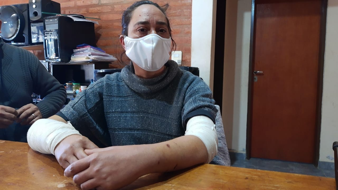 Feroz ataque de cinco perros a una mujer: “el casco de la moto le salvó la vida” | Nacionales