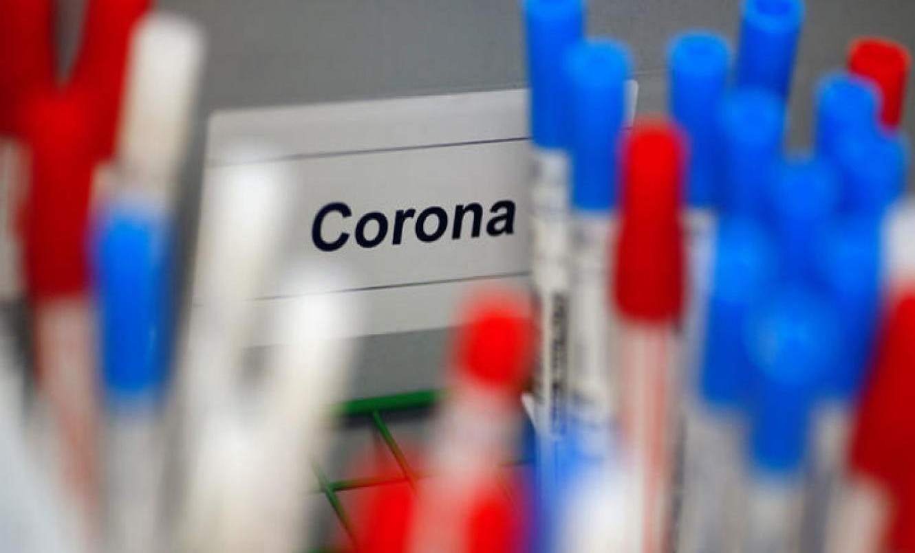 Coronavirus: el país superó la barrera de los 7000 contagios por segundo día consecutivo | Información General