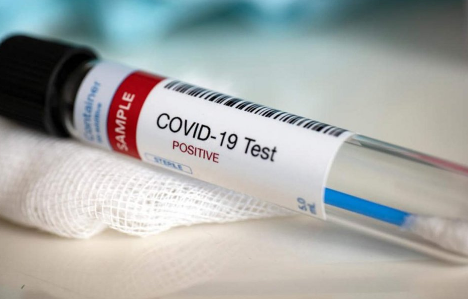 Entre Ríos superó los 1.000 casos de Covid19: Hubo 63 este viernes, 54 en Paraná | Noticias