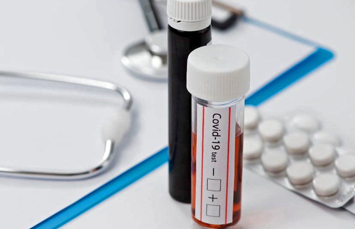 Argentina superó los 250 mil casos de Coronavirus | Información General