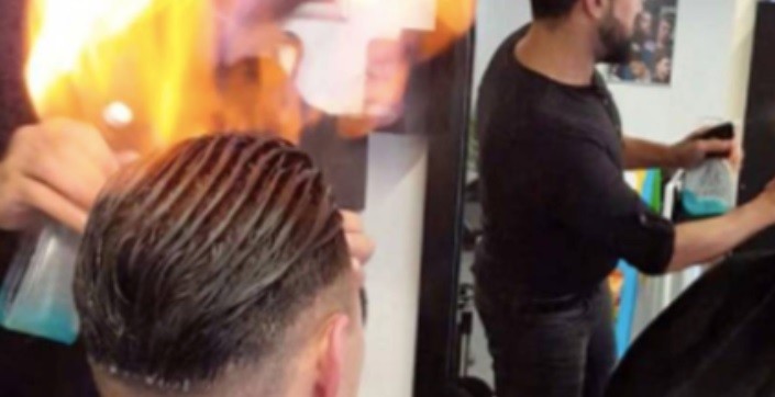 El peluquero decidió usar "técnica egipcia", prendió fuego el pelo del cliente y le provocó quemaduras | Redes