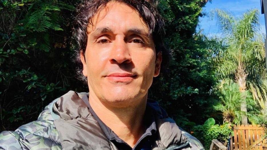 Sebastián Estevanez mostró como le quedó la cara luego de un accidente doméstico | Espectaculos