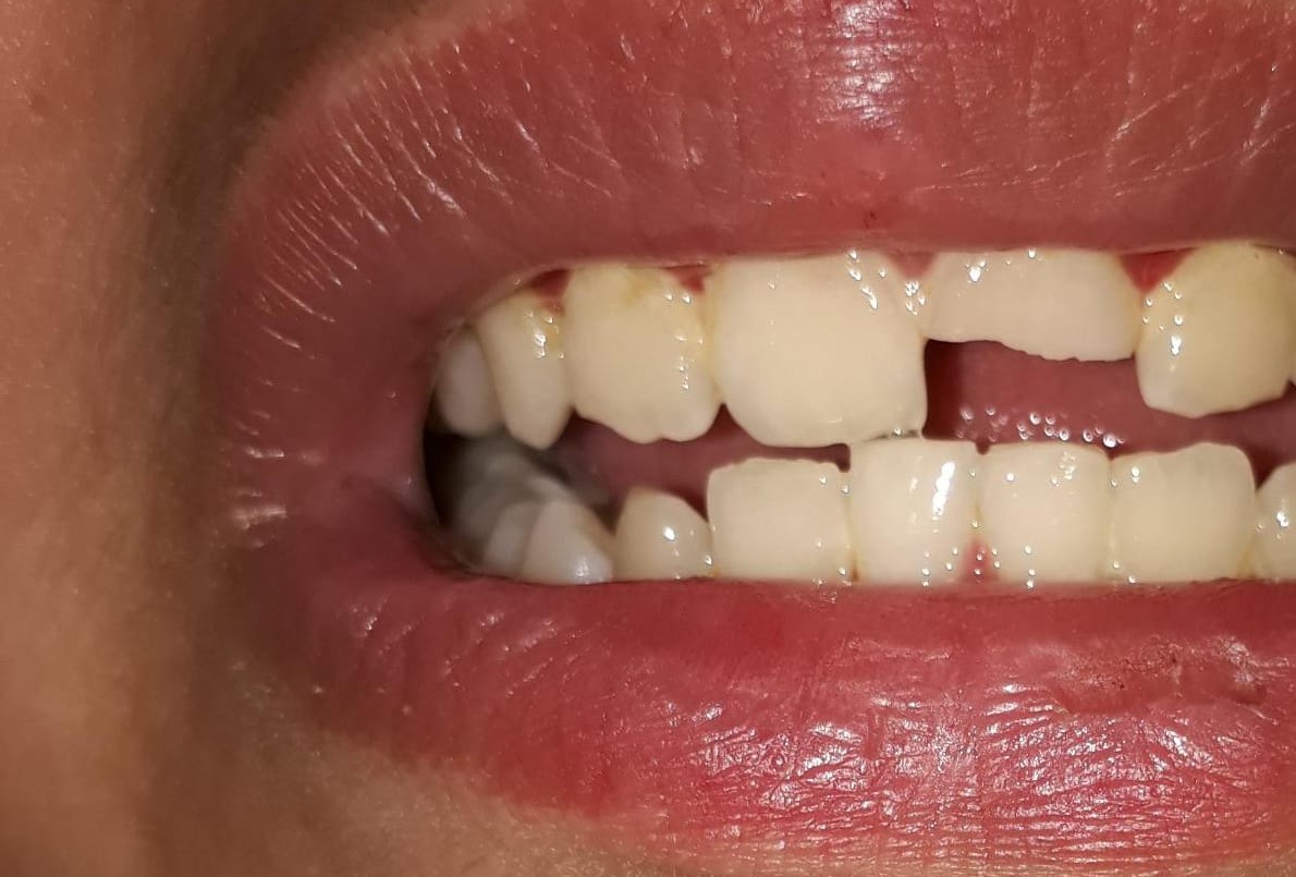 Un hombre golpeó a su hijo de 12 años y amenazó con tirarlo a las vías del tren | Nacionales