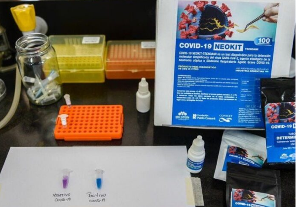 “Neokit-Covid-19”: de Argentina al mundo | Información General