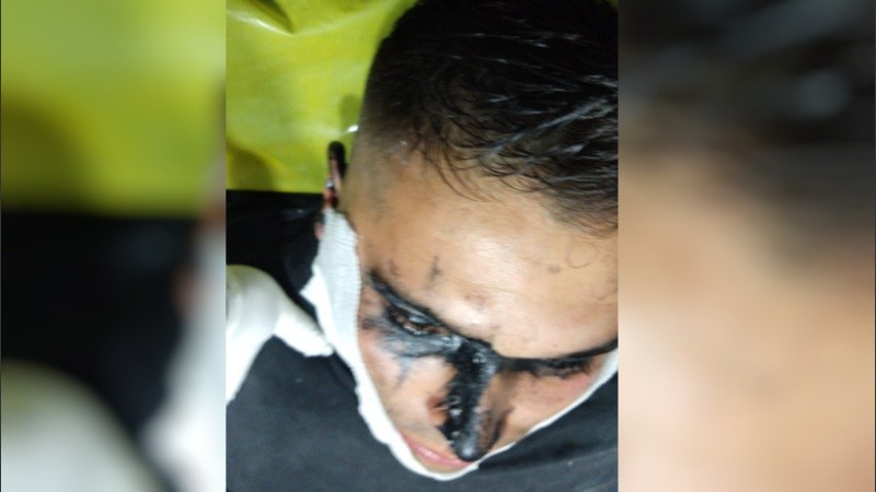 Su madre lo denunció por violento: antes de ser detenido, le arrojó pintura asfáltica en la cara a un policía | Noticias