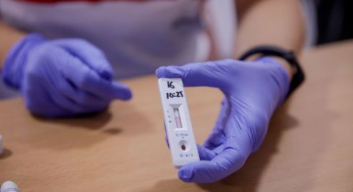 Lanzarán test de antígenos que permite diagnosticar el covid-19 en 18 minutos | Información General