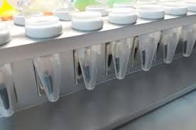 Desarrollan un kit que extrae el gen del coronavirus con nanopartículas como imán | Información General