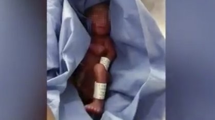 Video: dieron muerto a un bebé por error y estuvo 6 horas en la morgue | Redes