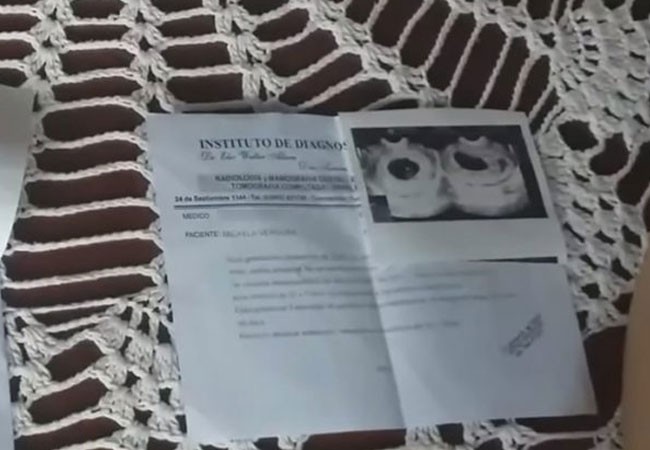"Hace un mes tengo a mi bebé sin vida en mi panza": no puede pagar los $25 mil de la operación | Nacionales