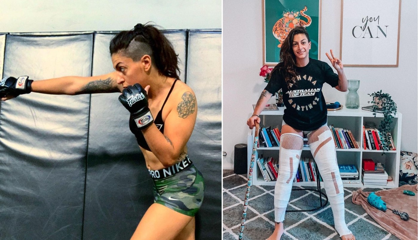Luchadora de MMA casi pierde las piernas en una sesión de crioterapia | Deportes
