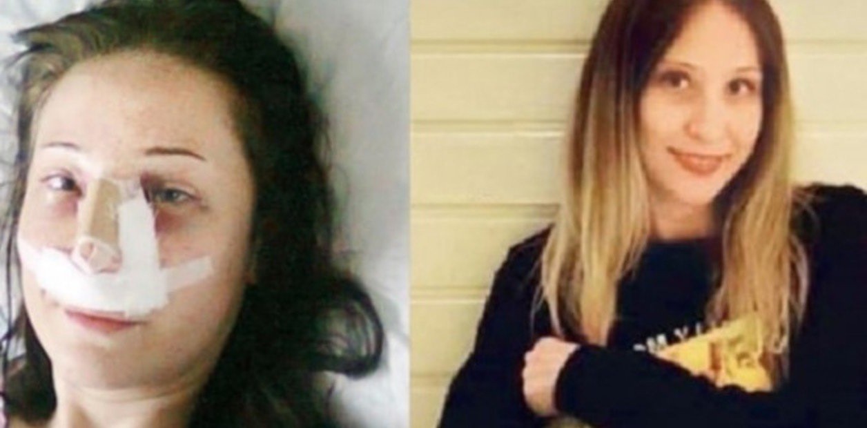 Fue al hospital para una cirugía estética en la nariz y terminó con las piernas amputadas | Redes