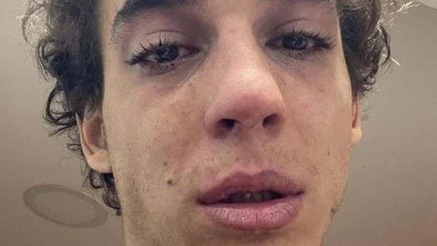 Preocupación por la confesión de uno de los actores de La casa de papel: "Ya no quiero hablar, ni comer" | Espectaculos