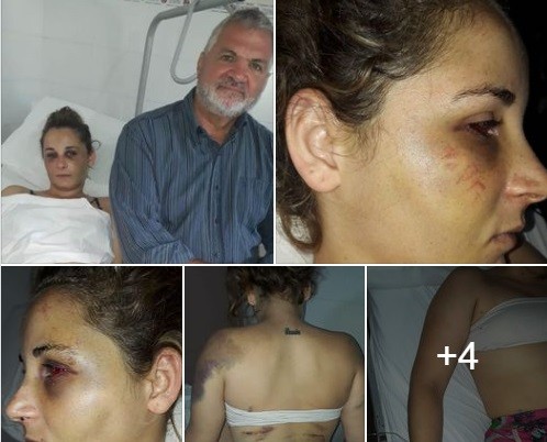 San Carlos Centro: Brutal golpiza de un hombre a su pareja | Noticias