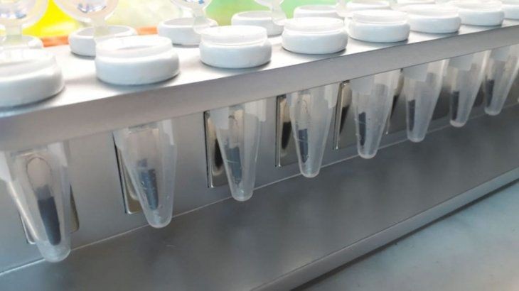 Coronavirus: científicos argentinos desarrollan un kit que acelera los testeos | Nacionales