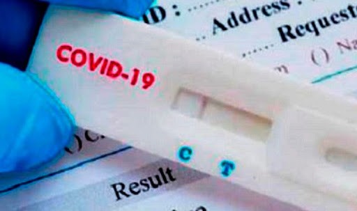 Autorizaron a vender en farmacias un test rápido de coronavirus: precio y cómo funciona | Nacionales