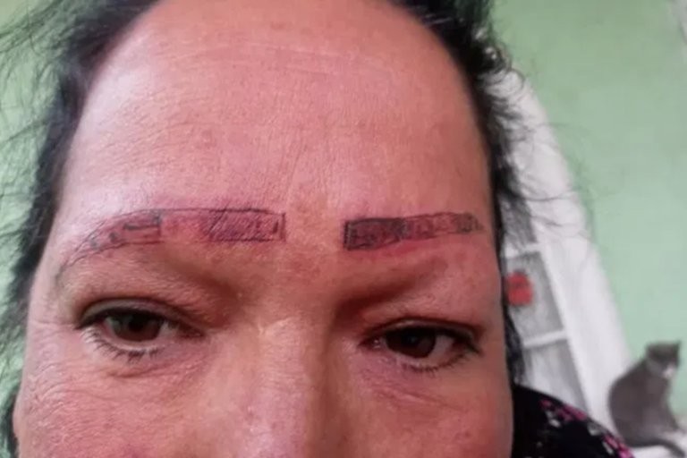 Se viralizó la denuncia de una joven por tatuadores que la estafaron y le arruinaron la cara | Redes