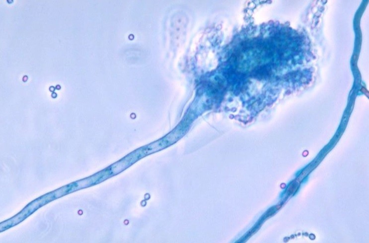 Estudio: científicas argentinas detectan un hongo que causa infección en pacientes graves con coronavirus | Información General