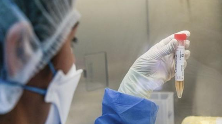 Expertos aconsejan completar las segundas dosis ante la variante Delta | Noticias