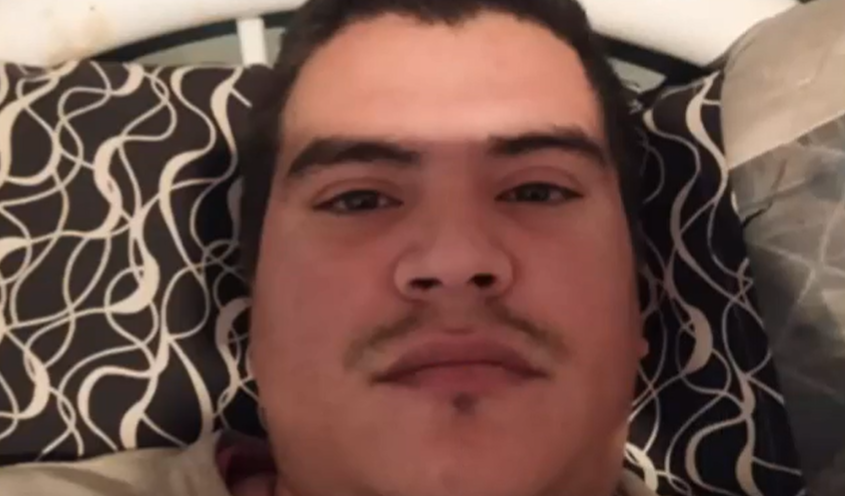 Le destrozaron la mandíbula para robarle $100 y un celular viejo: sus padres piden ayuda para una prótesis | Nacionales