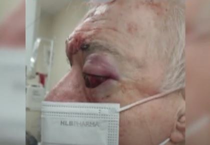 Un jubilado defendió a su familia y terminó baleado en la cara | Nacionales