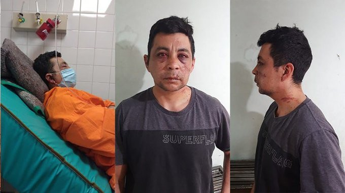 Murió el enfermero linchado hace un año por contagiarse covid: "Nunca se recuperó del rechazo social" | Nacionales