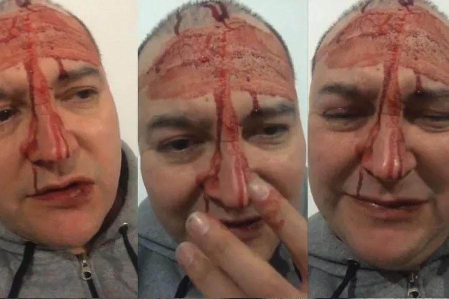 El video del brutal ataque a Leo García | Espectaculos