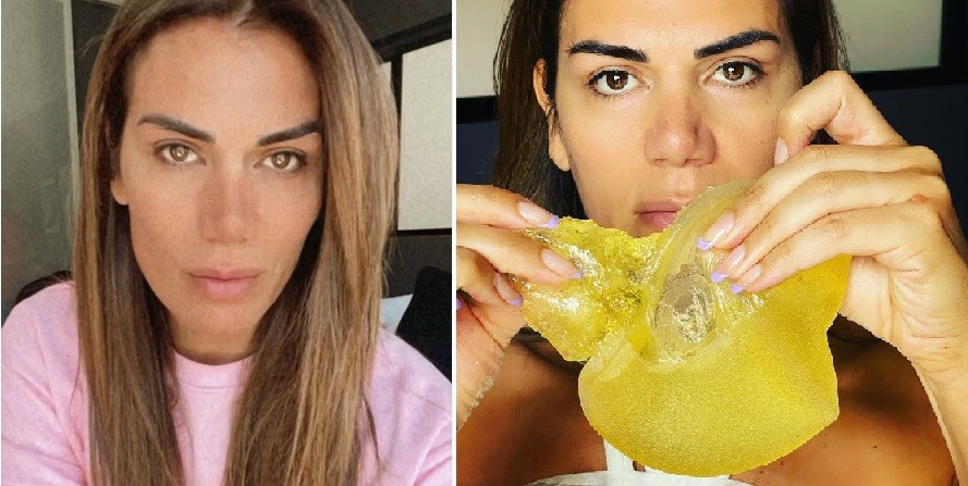 Flor de la V contó que debió operarse por una fisura en un implante mamario | Espectaculos